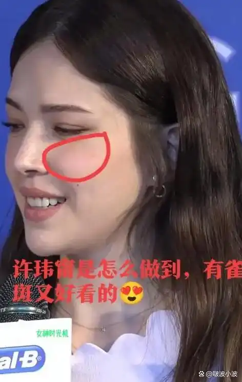 许玮甯雀斑为什么好看_国内雀斑多的女明星_许玮甯雀斑好看吗